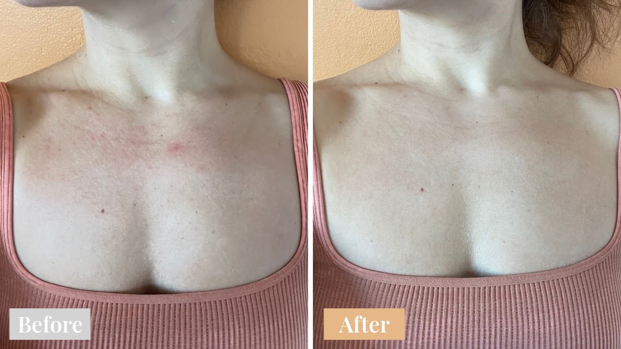 Omnilux Contour Neck & Décolleté LED Light Therapy Mask
