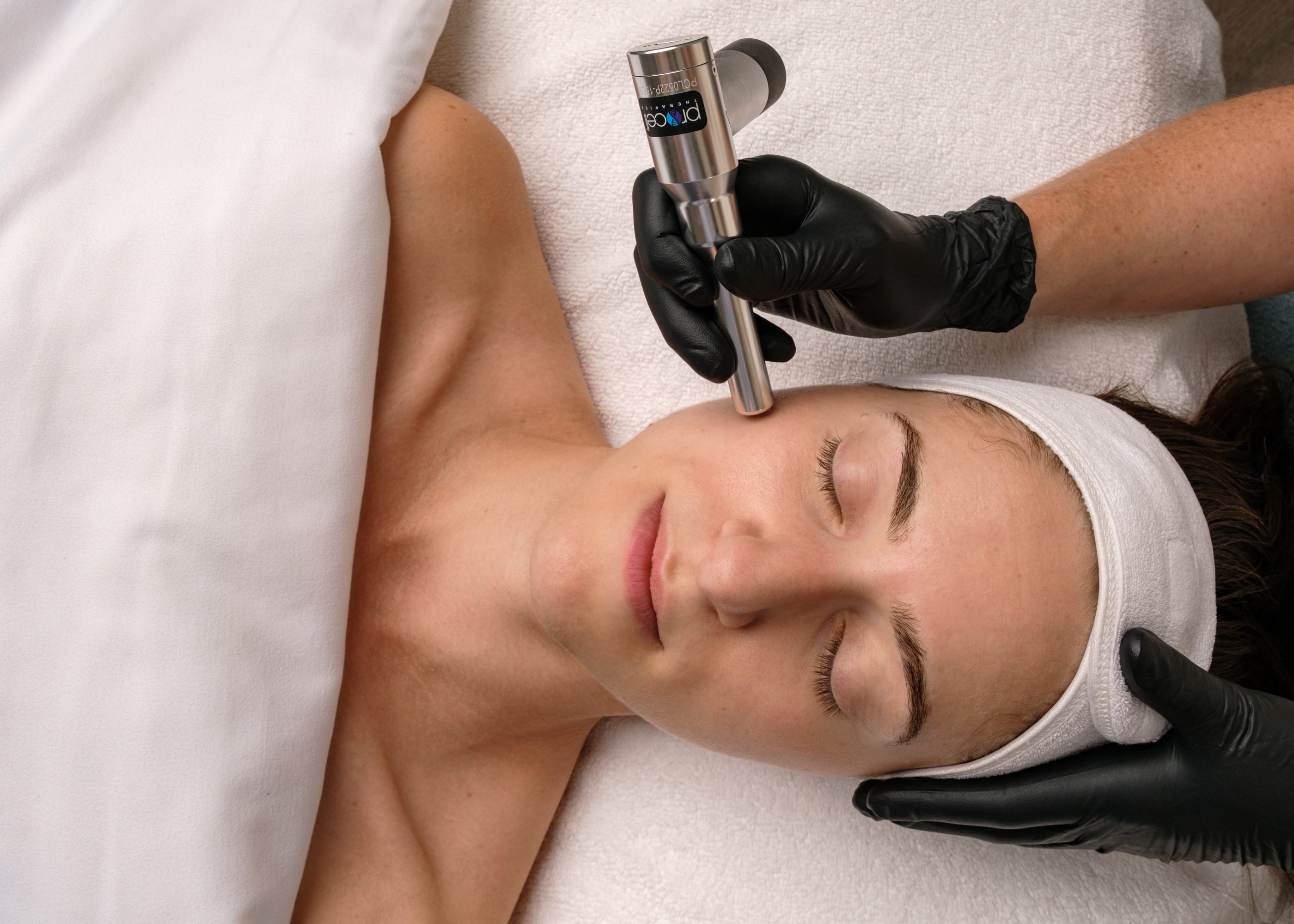 Burnaby microneedling