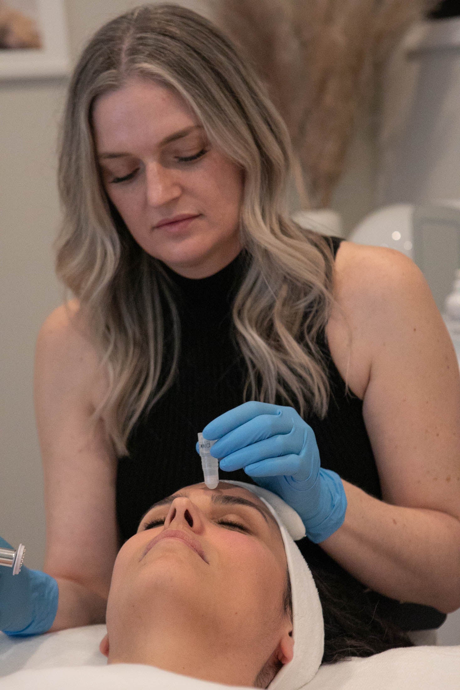 Burnaby microneedling treatment